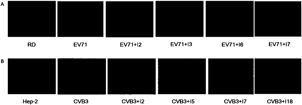 Thiazole heterocyclic ring-containing steroid derivative as well as preparation method and application thereof