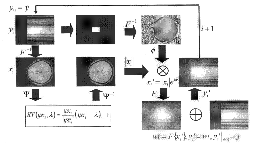 Partial echo compressed sensing-based quick magnetic resonance imaging method