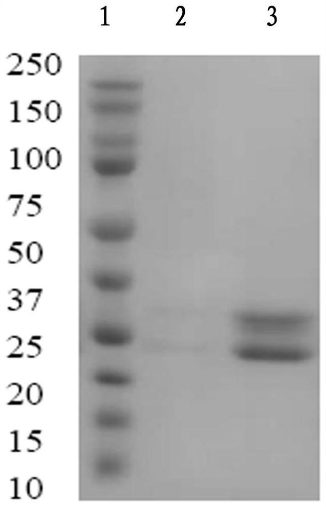 A kind of anti-complement c5 molecule humanized single-chain antibody and its application