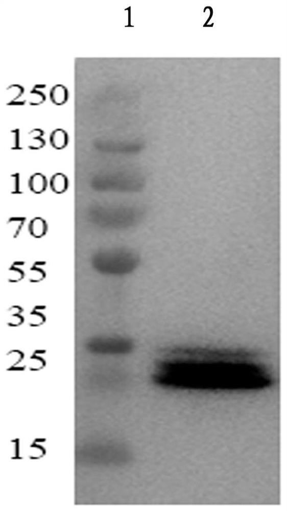 A kind of anti-complement c5 molecule humanized single-chain antibody and its application