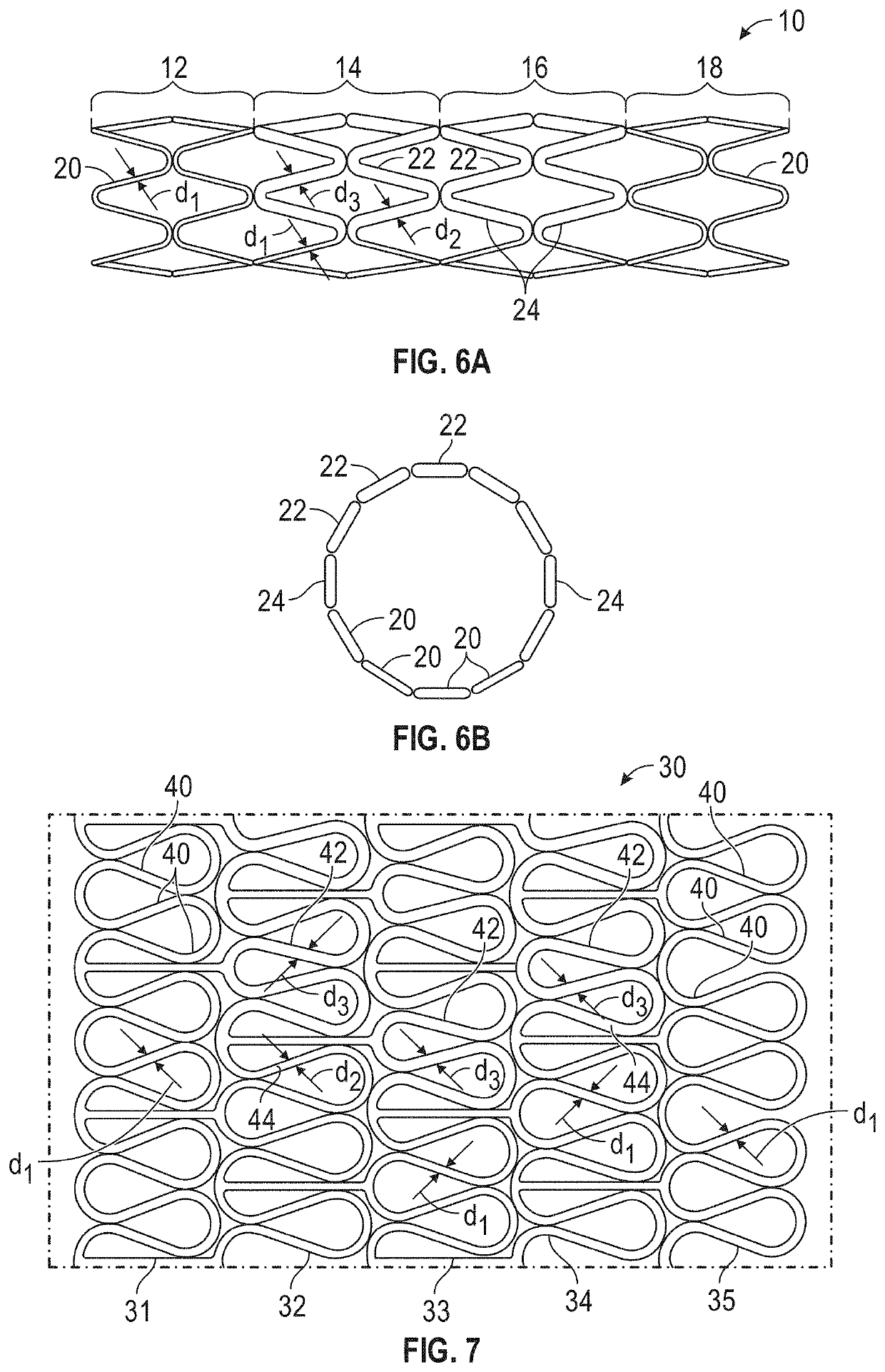 Apparatus and methods for treating venous compression/obstruction syndromes