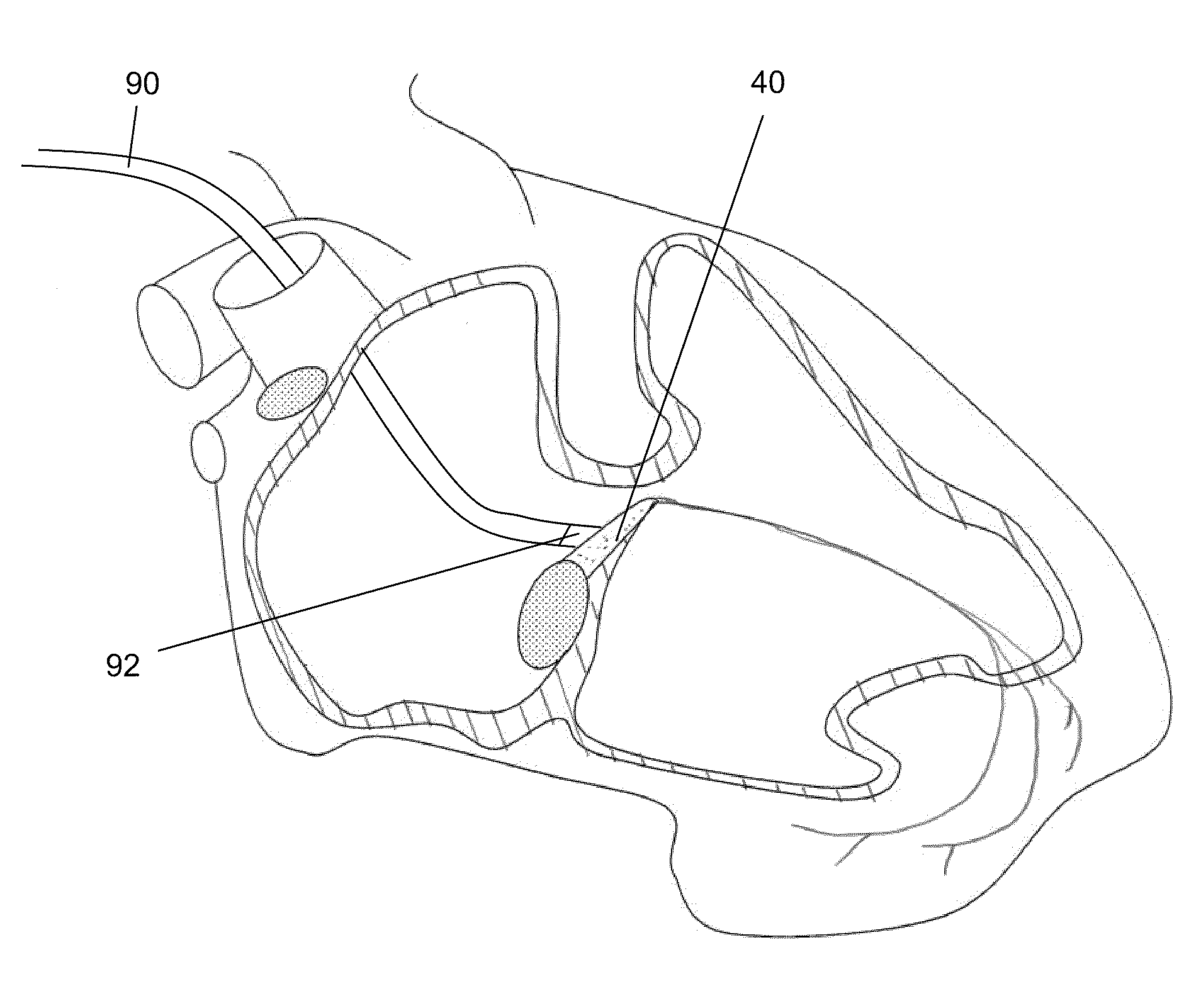 Generation of biological pacemaker activity