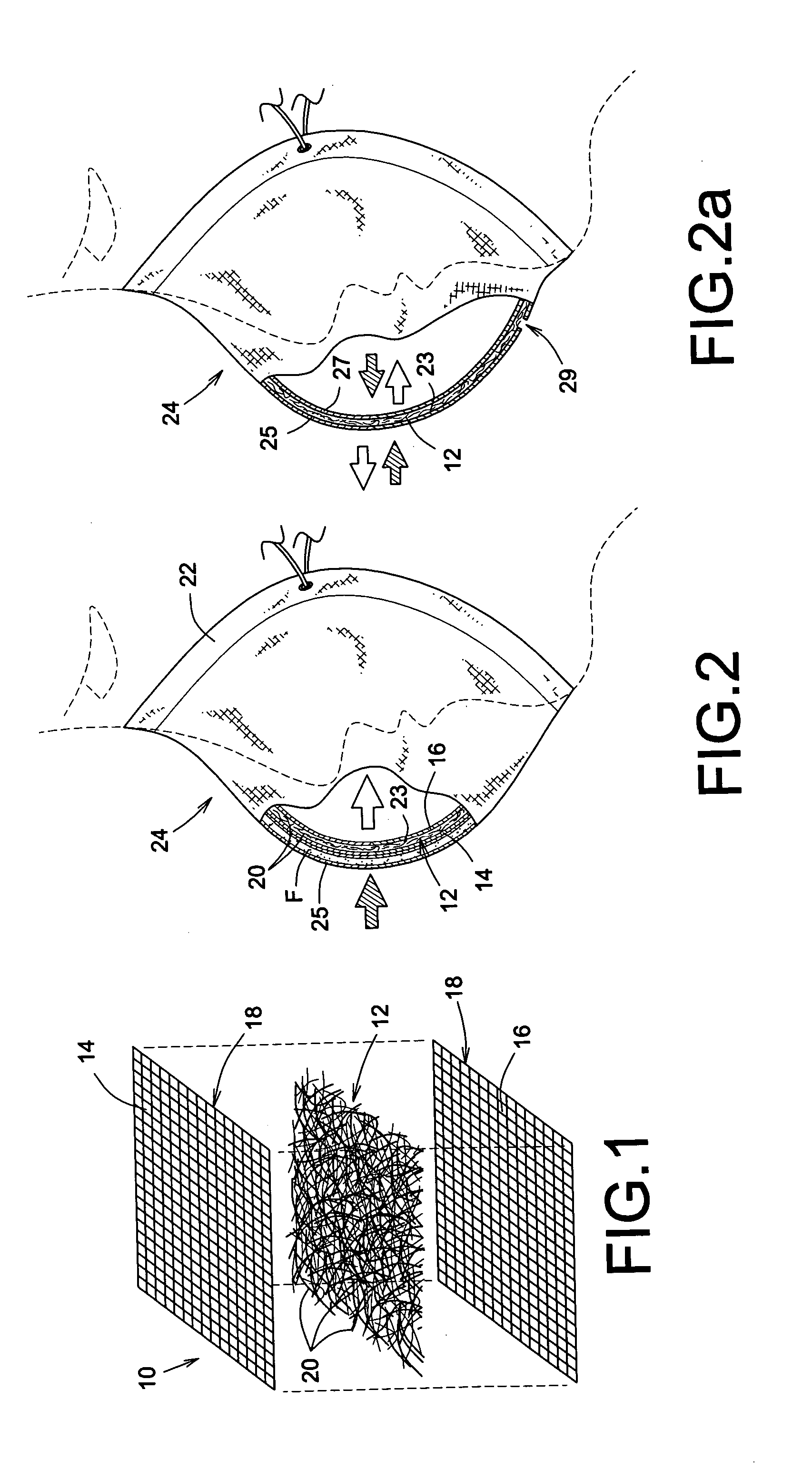 Microbicidal air filter