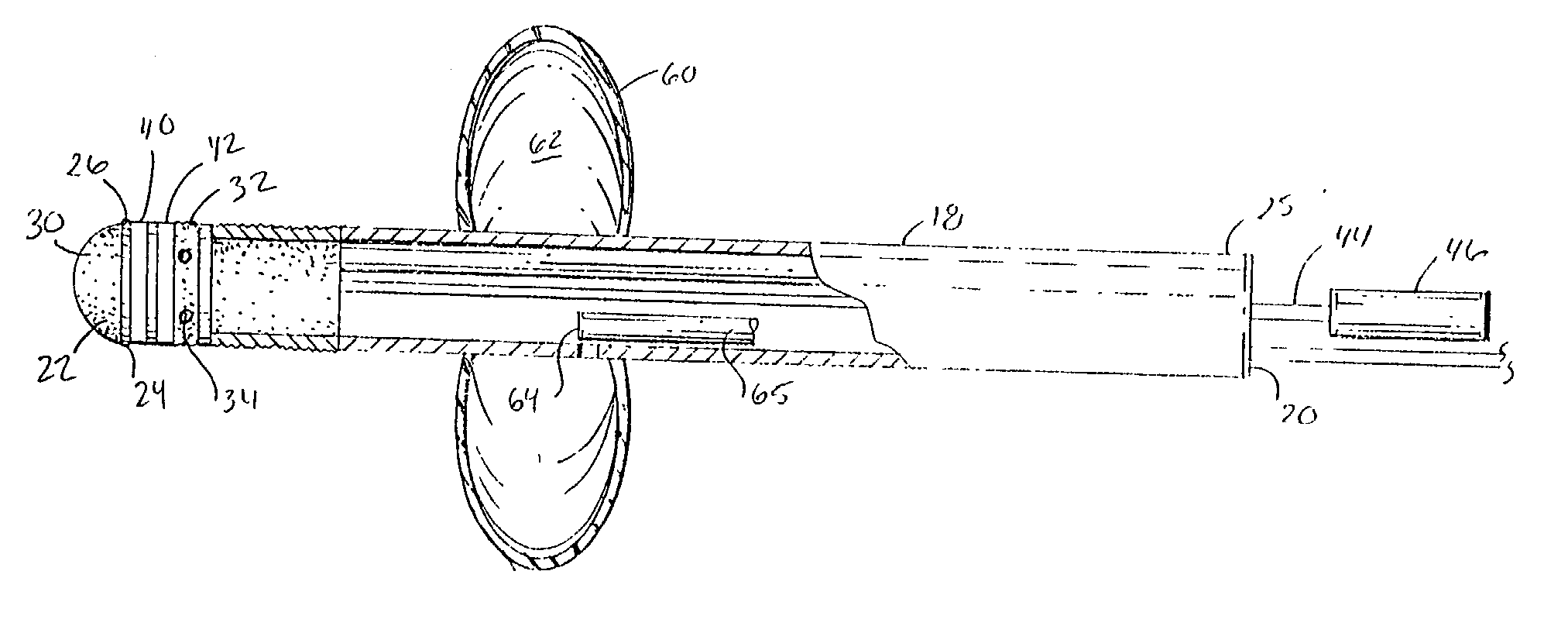 Bowel probe & method for controlling bowel incontinence