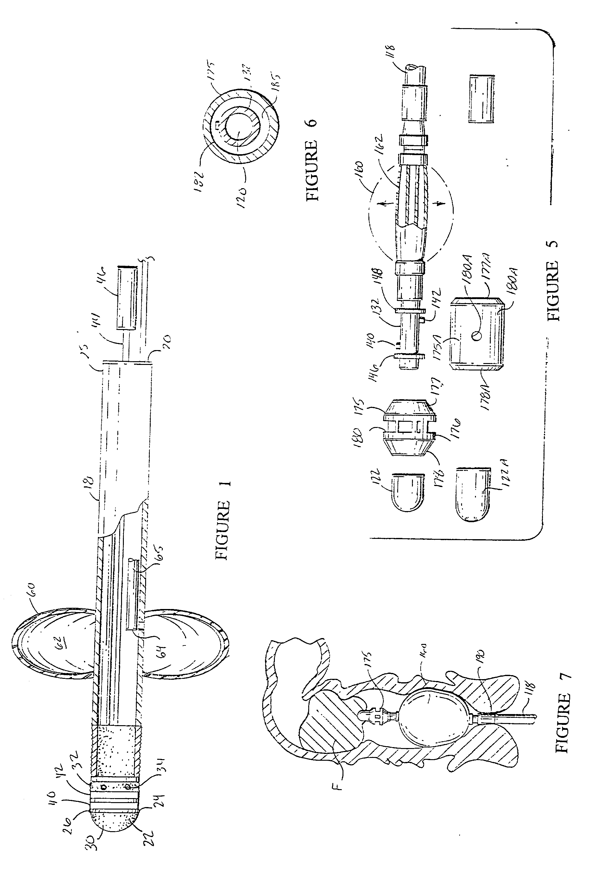 Bowel probe & method for controlling bowel incontinence