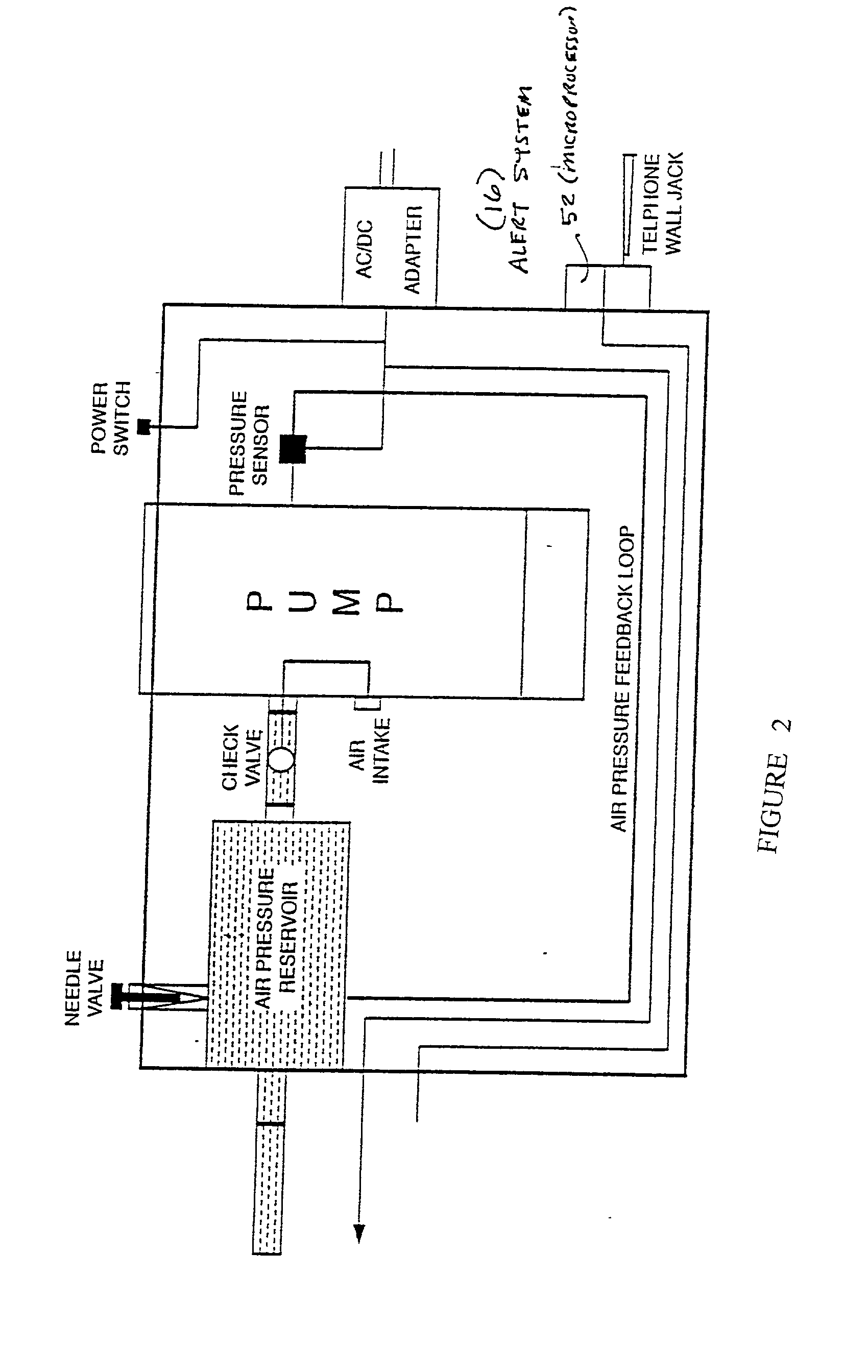 Bowel probe & method for controlling bowel incontinence