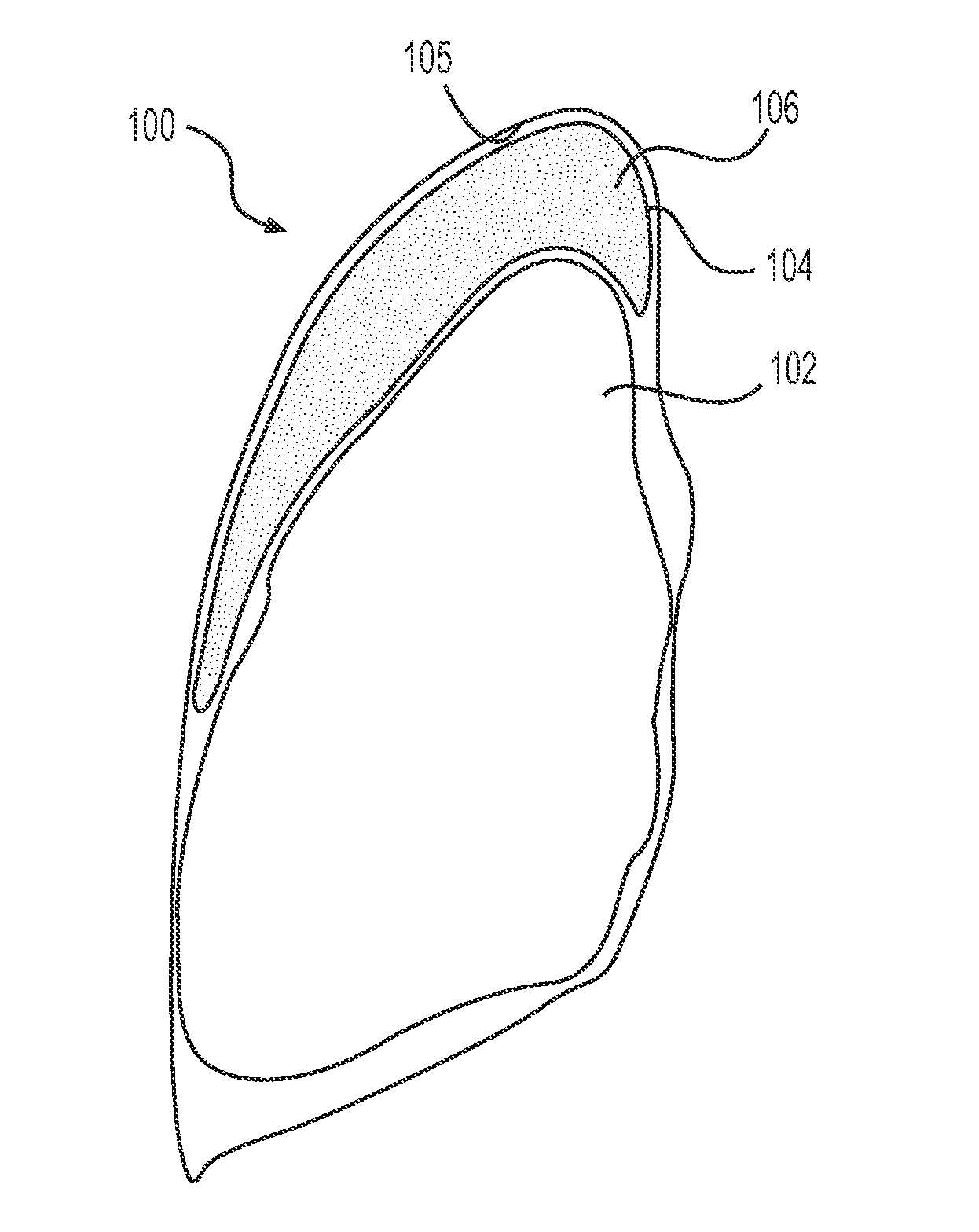 Devices for sizing a cavity to fit an organ and related methods of use