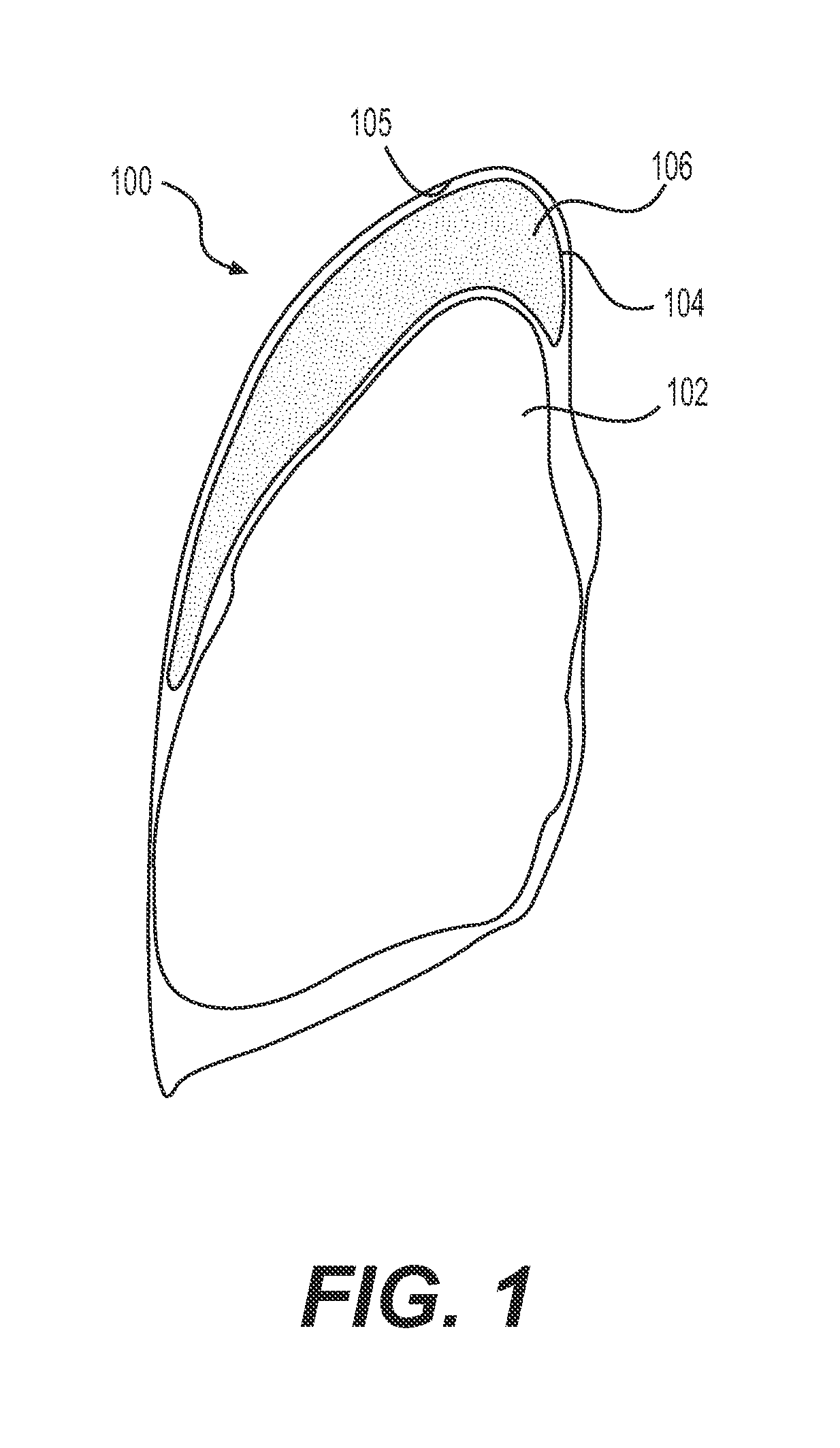 Devices for sizing a cavity to fit an organ and related methods of use