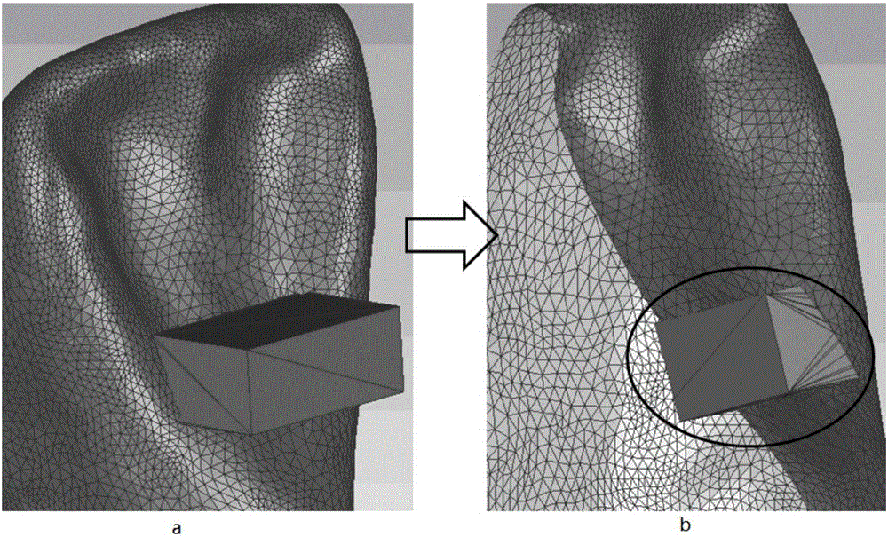 Invisible appliance with pressure accessory and making method thereof