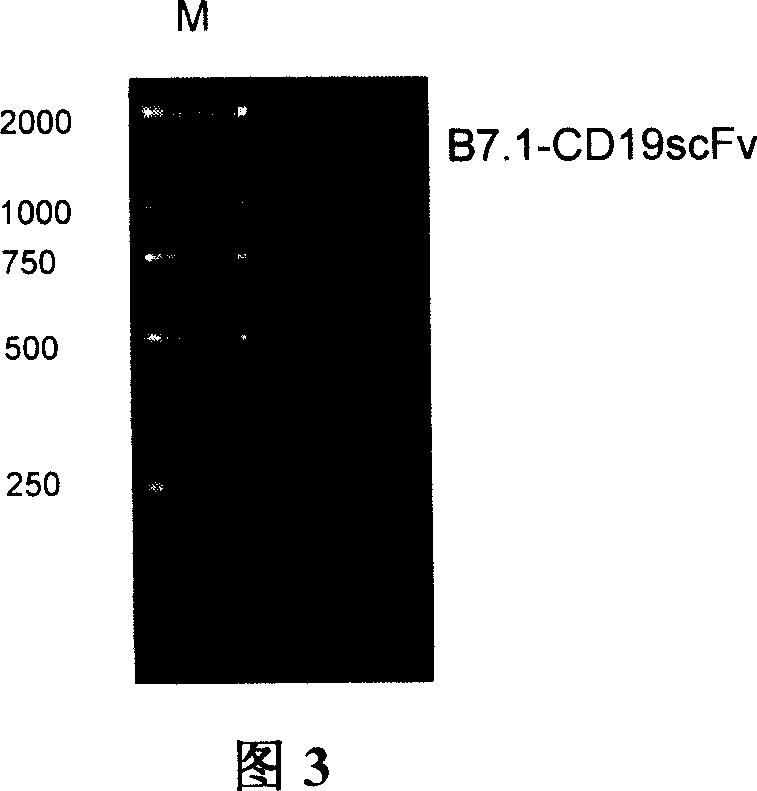 B7. 1-CD19scFv fusion gene engineering albumen for treating B lymphocyte leukemia and lymph tumour and use thereof