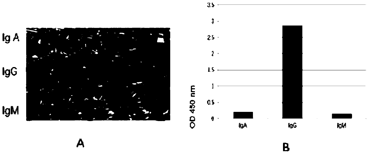 Anti-REG gamma C terminal region monoclonal antibody and preparation and application thereof