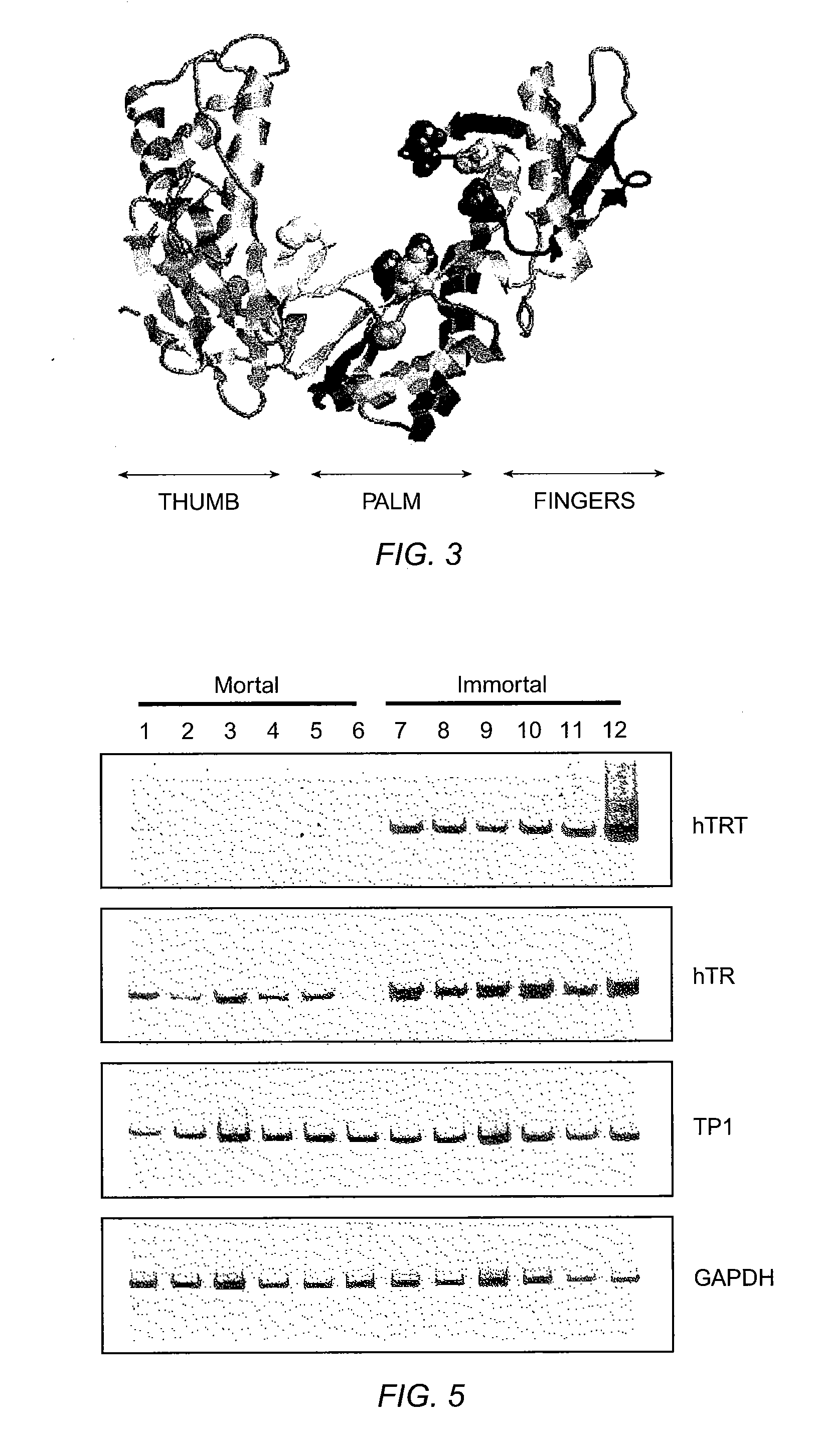 Kit for detection of telomerase reverse transcriptase nucleic acids