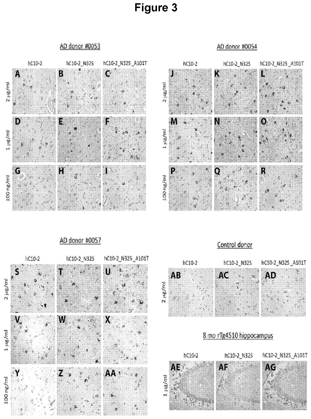 Antibodies specific for hyperphosphorylated tau and methods of use thereof