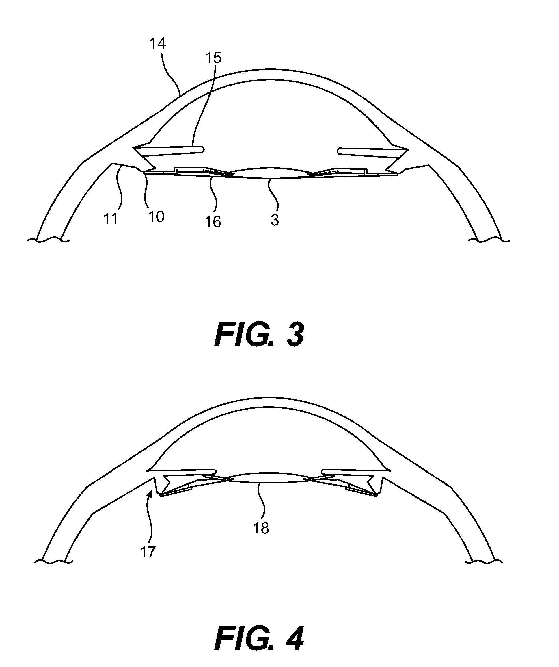 Haptic devices for intraocular lens