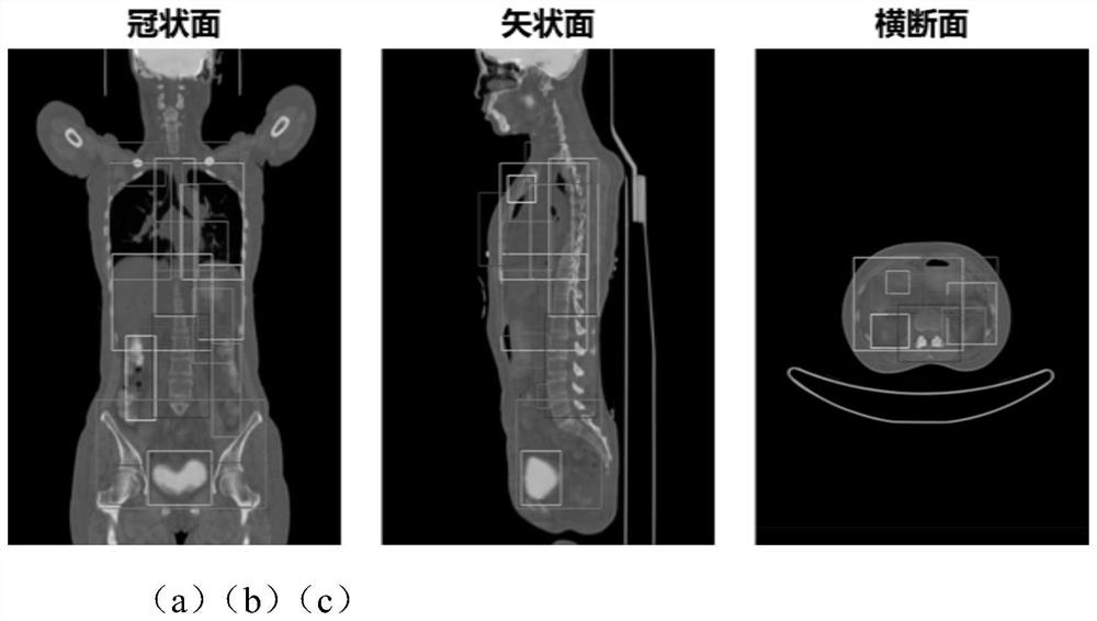 Multi-modal medical image multi-organ positioning method based on one-to-one target query Transform