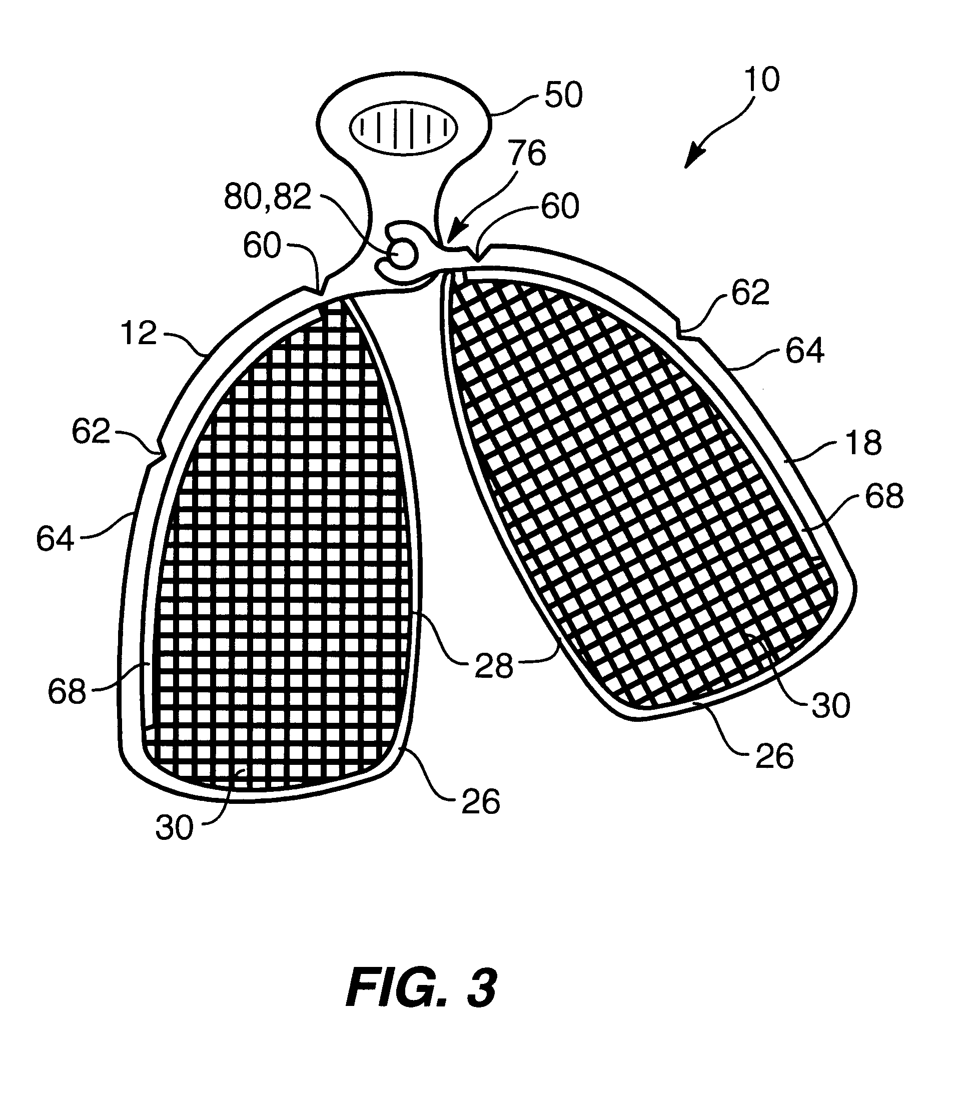 Adjustable dental impression tray and methods for using same