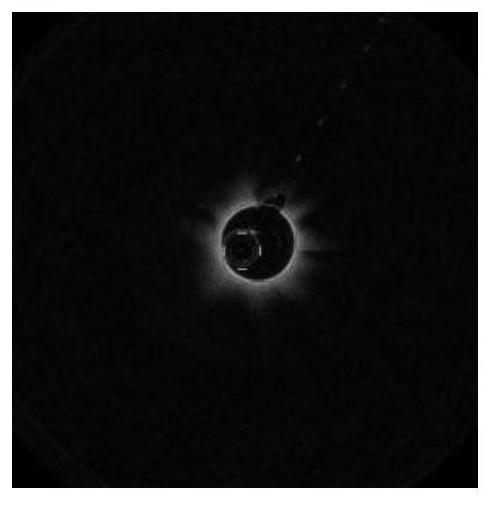 Deep network segmentation method for coronary artery lumen contour under OCT image