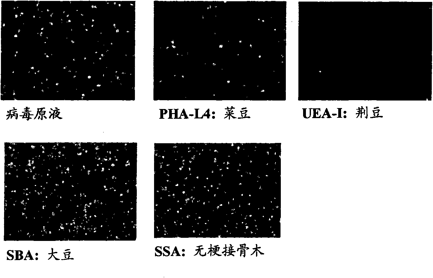 Method for concentration of virus