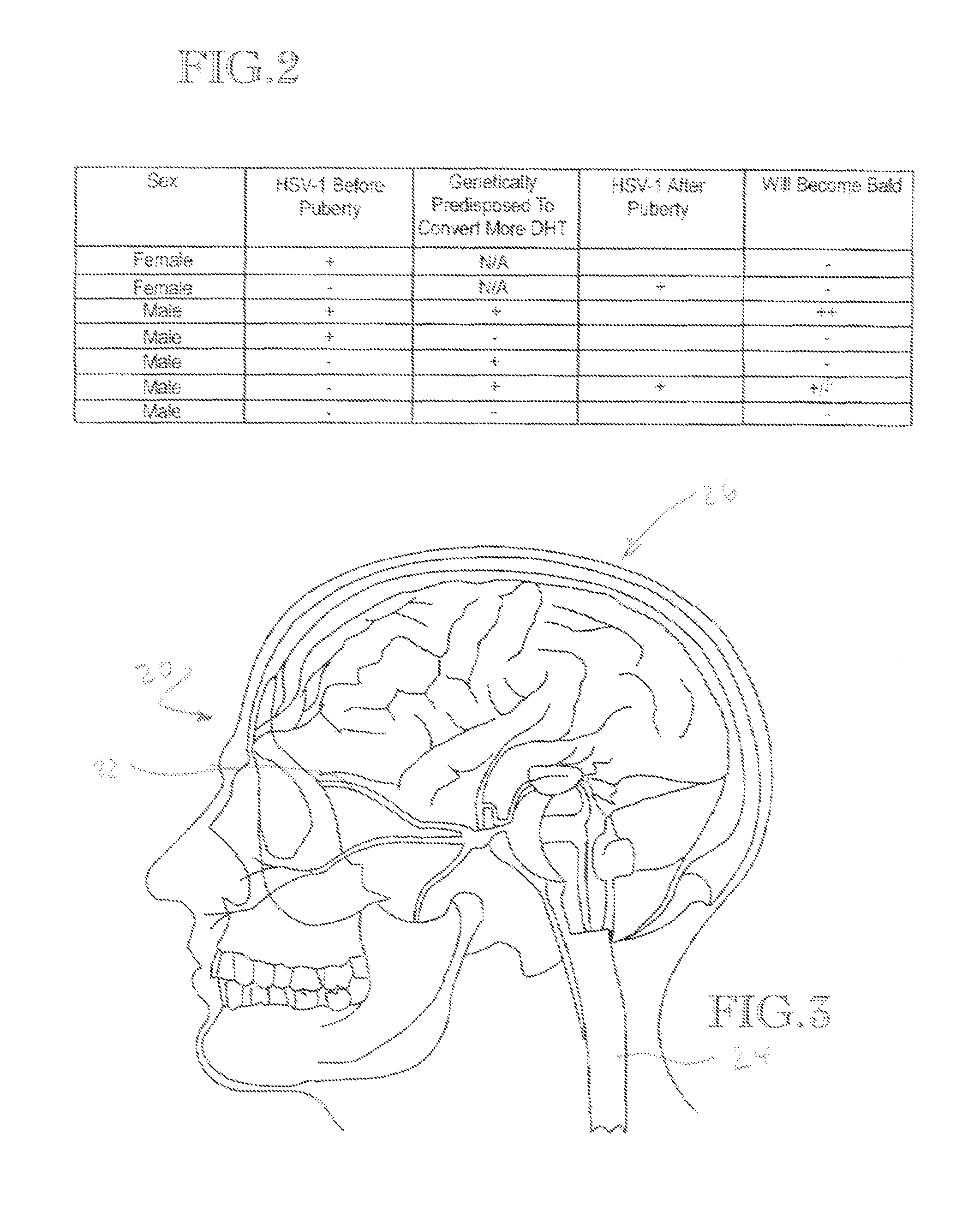 Method and kit for treatment/prevention of hair loss