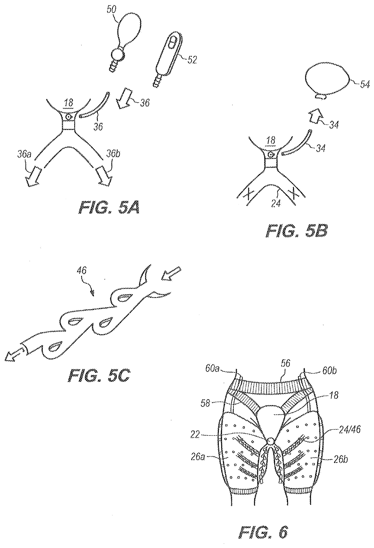 Device for in-flight urine elimination