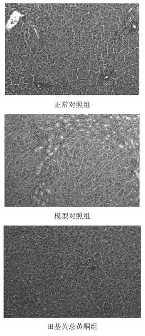 Application of hypericum japonicum thunb general flavone in preparing medicament for treating hepatic fibrosis