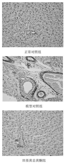 Application of hypericum japonicum thunb general flavone in preparing medicament for treating hepatic fibrosis