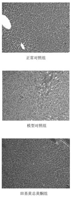 Application of hypericum japonicum thunb general flavone in preparing medicament for treating hepatic fibrosis