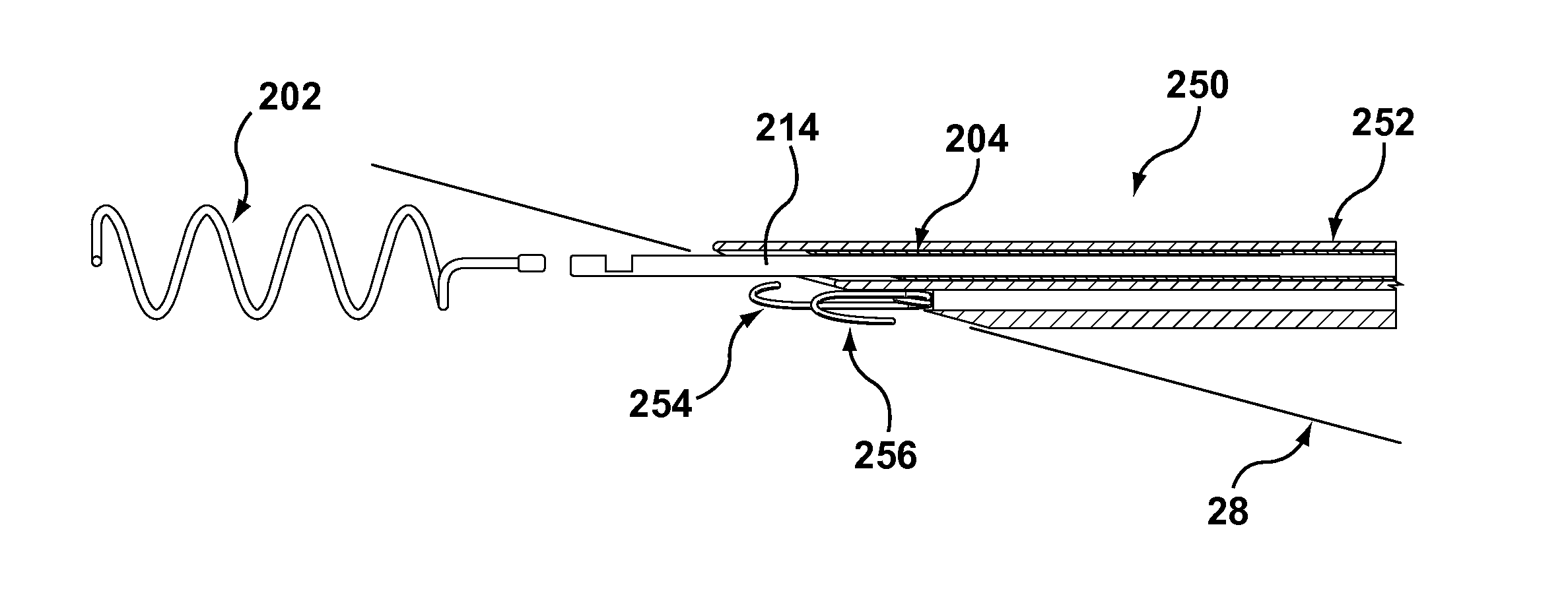 Helical coil mitral valve annuloplasty systems and methods