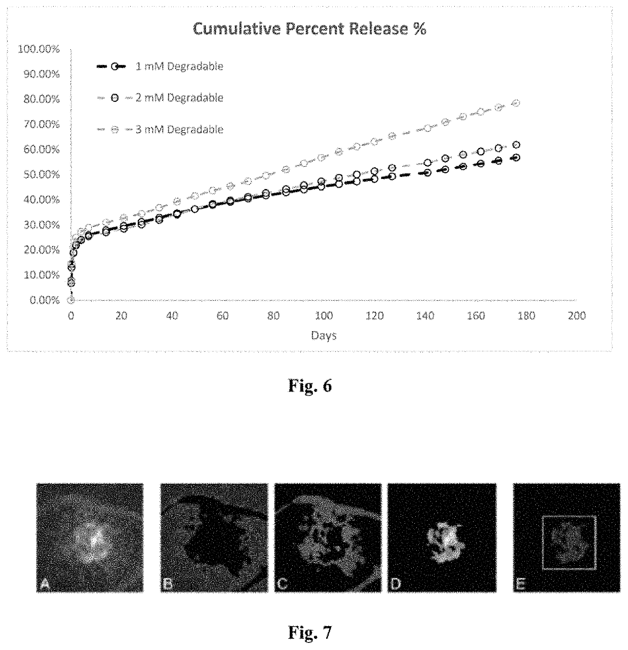 Biodegradable microsphere-hydrogel ocular drug delivery system