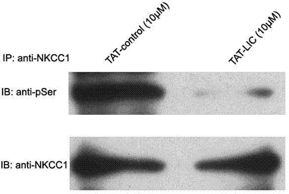 Recombined membrane-penetrating peptide with WNK (with no lysine (K)) kinase inhibiting effect