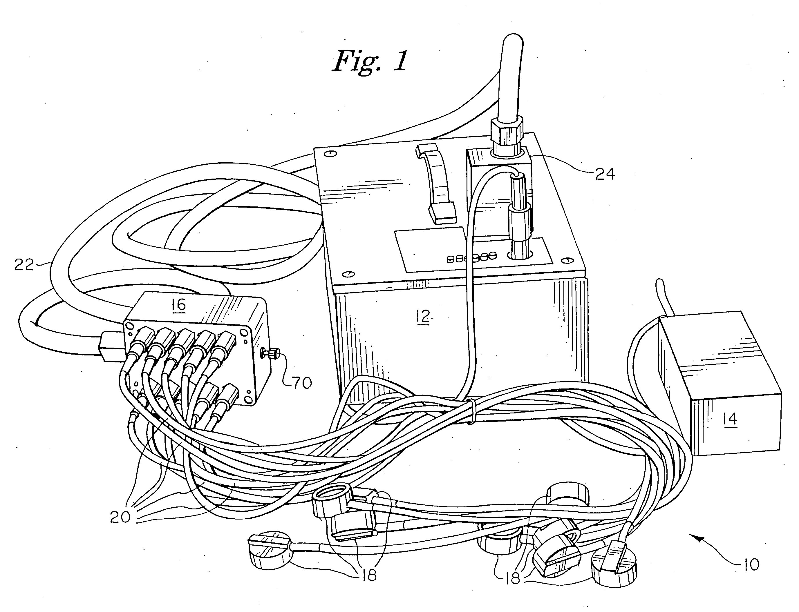 Venturi ECG electrode system