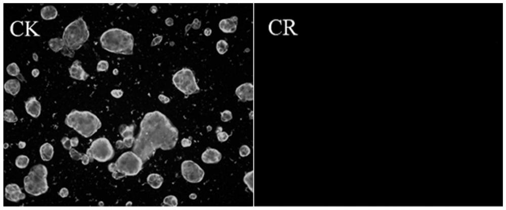 Human intestinal cancer primary cells, applications and culture methods