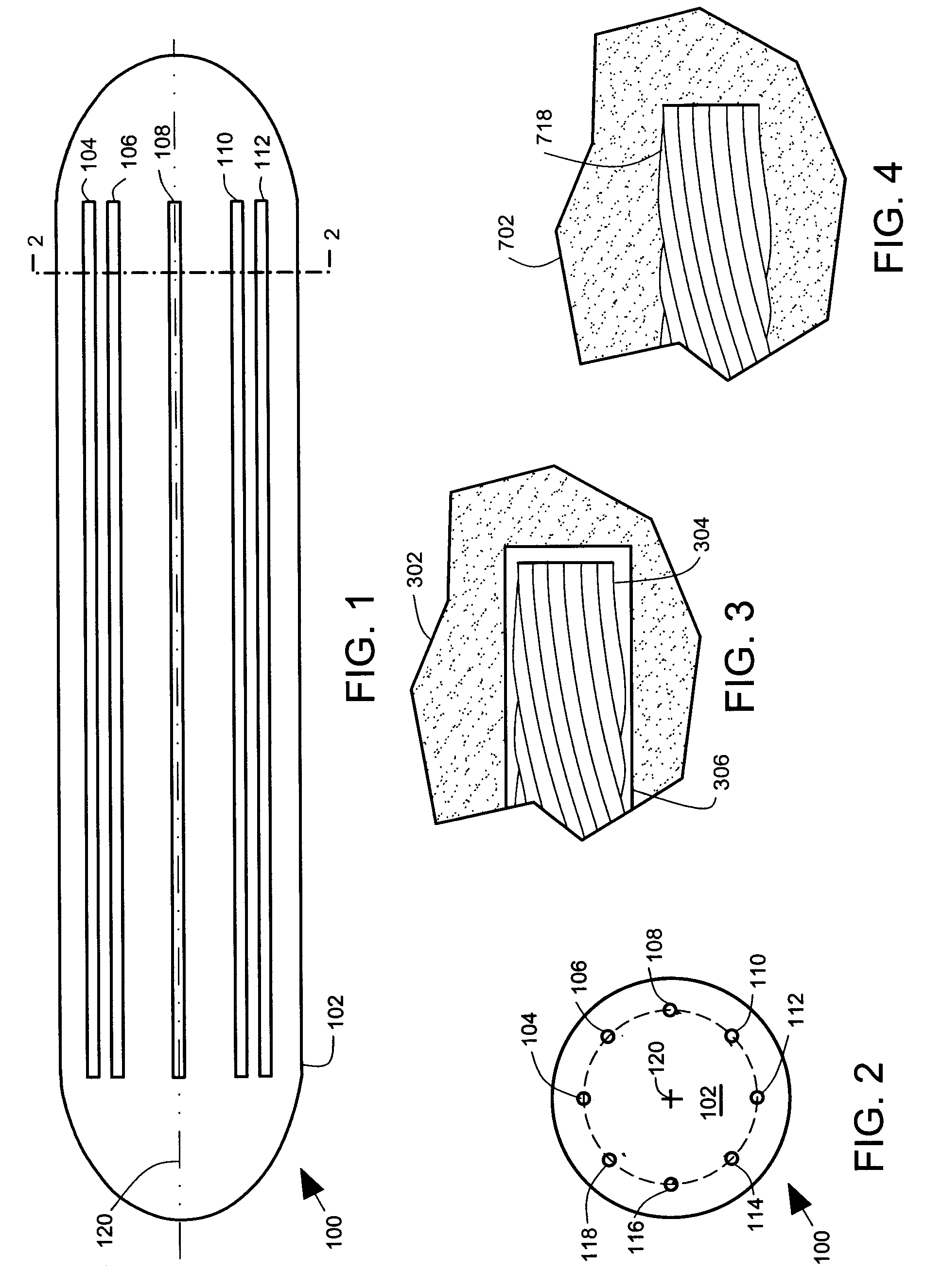 Malleable Prosthesis with Enhanced Concealability