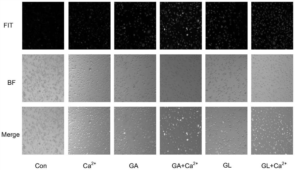 Multistage response injectable hydrogel loaded with gambogic acid and application thereof