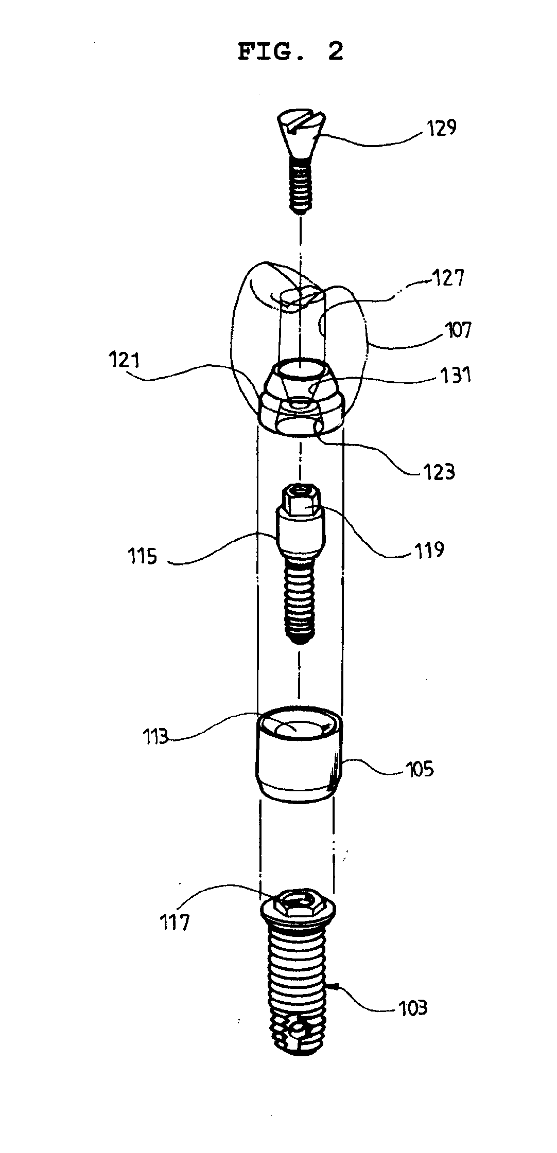 Waved Implant Integrating Soft Tissue Area and Osseous Tissue Area