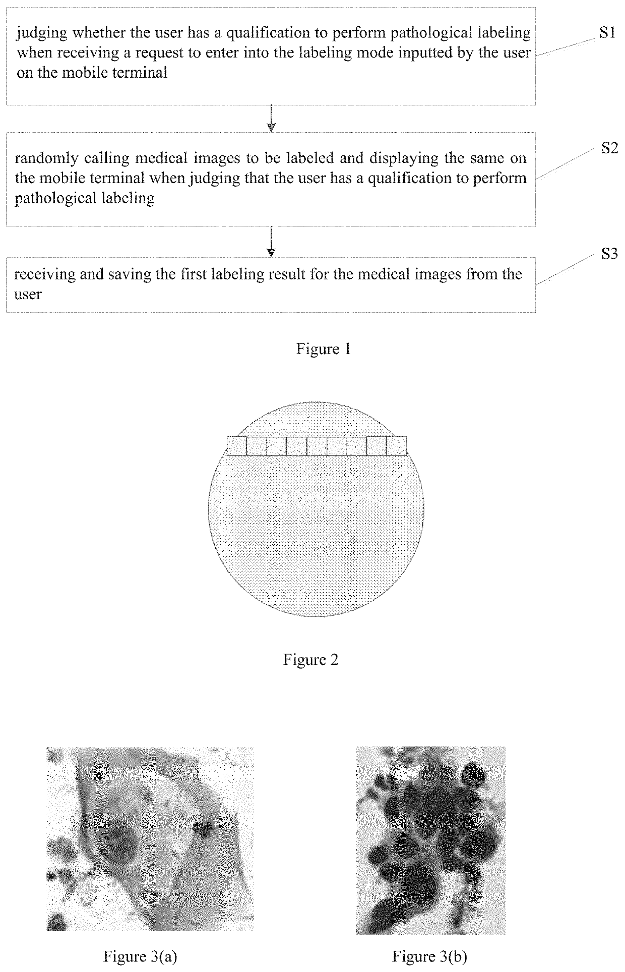 Methods and devices for pathologically labeling medical images, methods and devices for issuing reports based on medical images, and computer-readable storage media