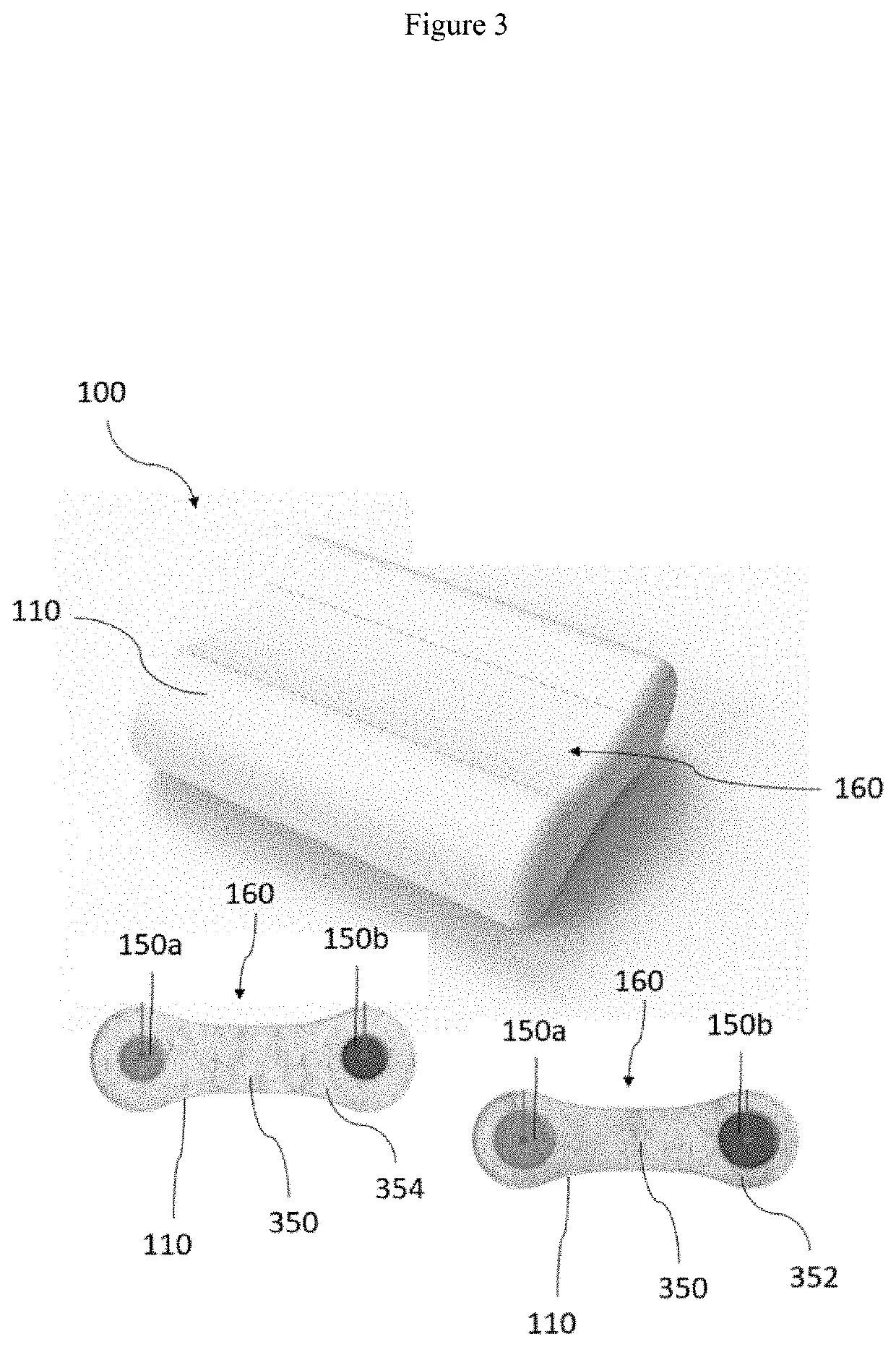 Neck and back pain relieving pillow