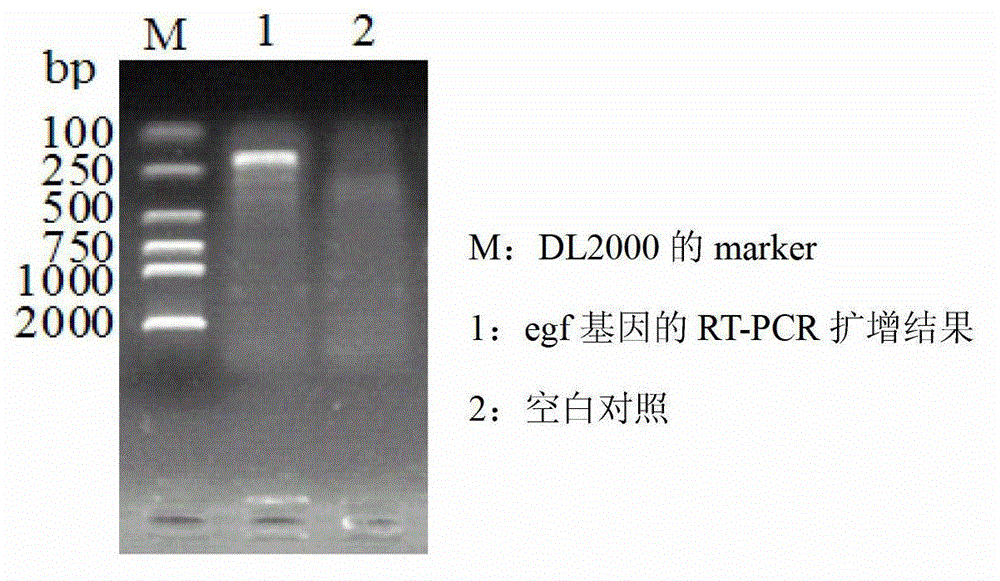 Construction method and purpose of recombinant lactobacillus acidophilus expressing pig epidermal growth factors