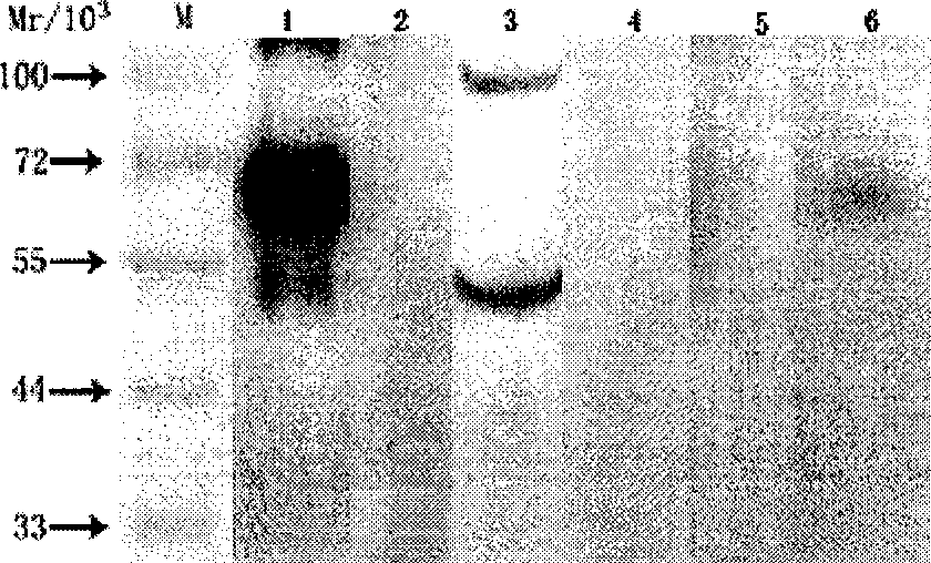 Method for preparing CYP4A11 polypeptide, and antibody for anti human CYP4A11 polypeptide