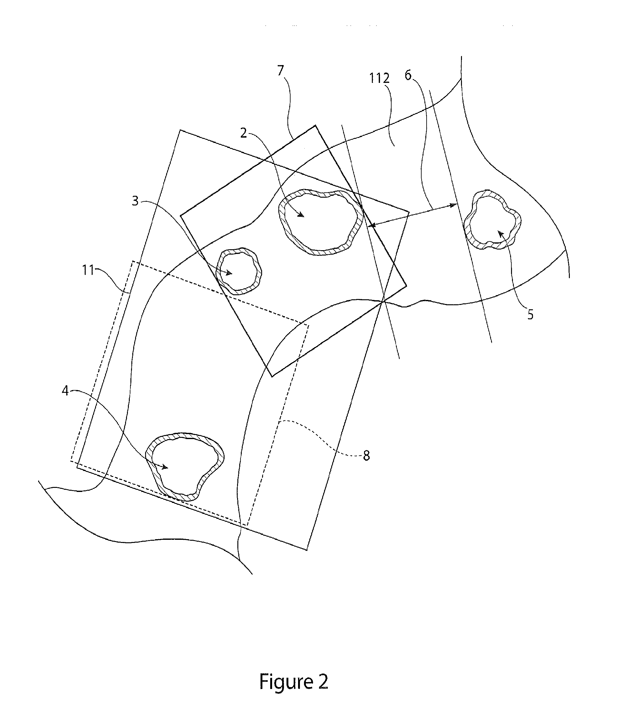 Medical device delivery system and deployment method