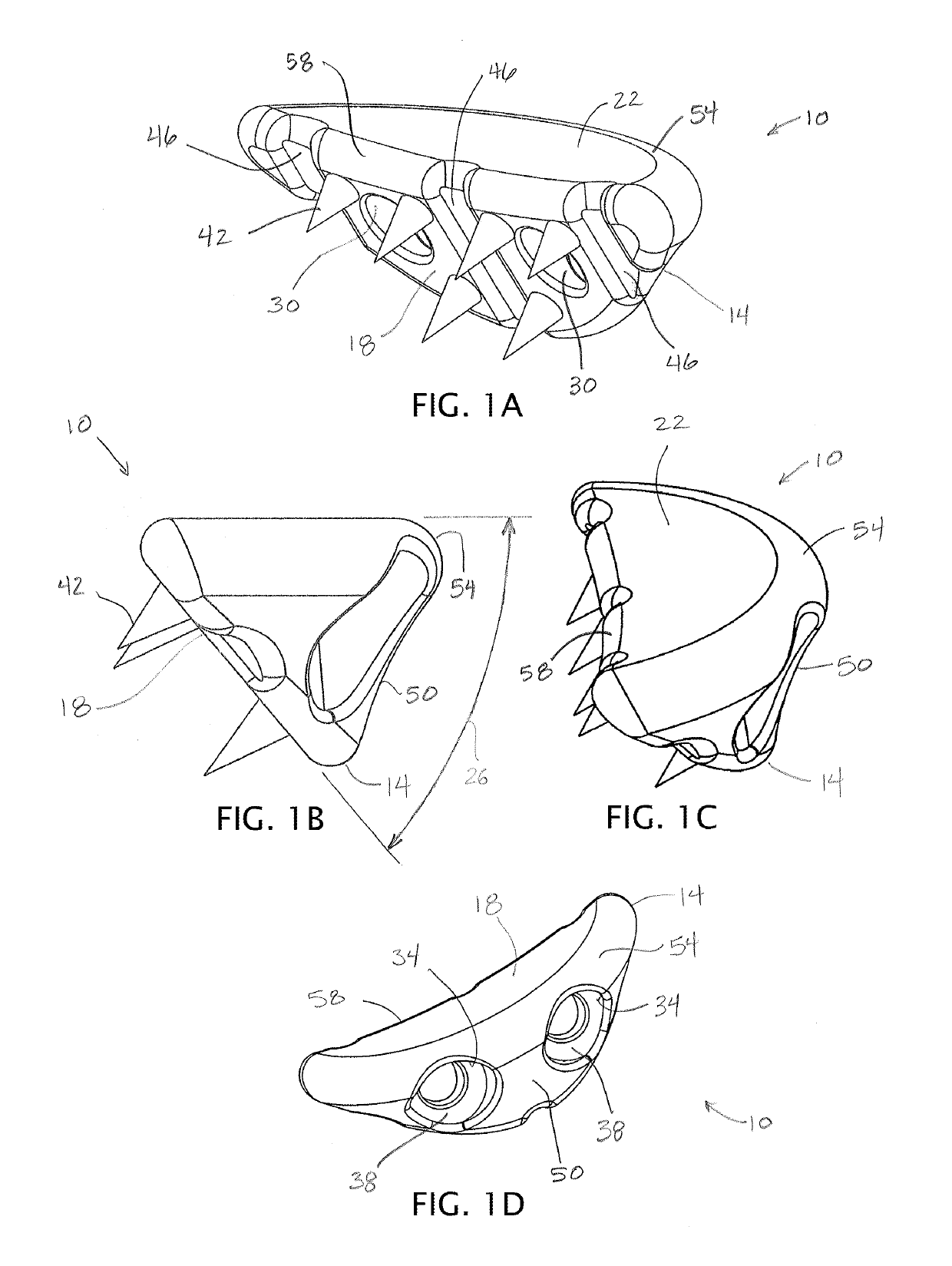 Devices, apparatuses, kits, and methods for repair of articular surface and/or articular rim