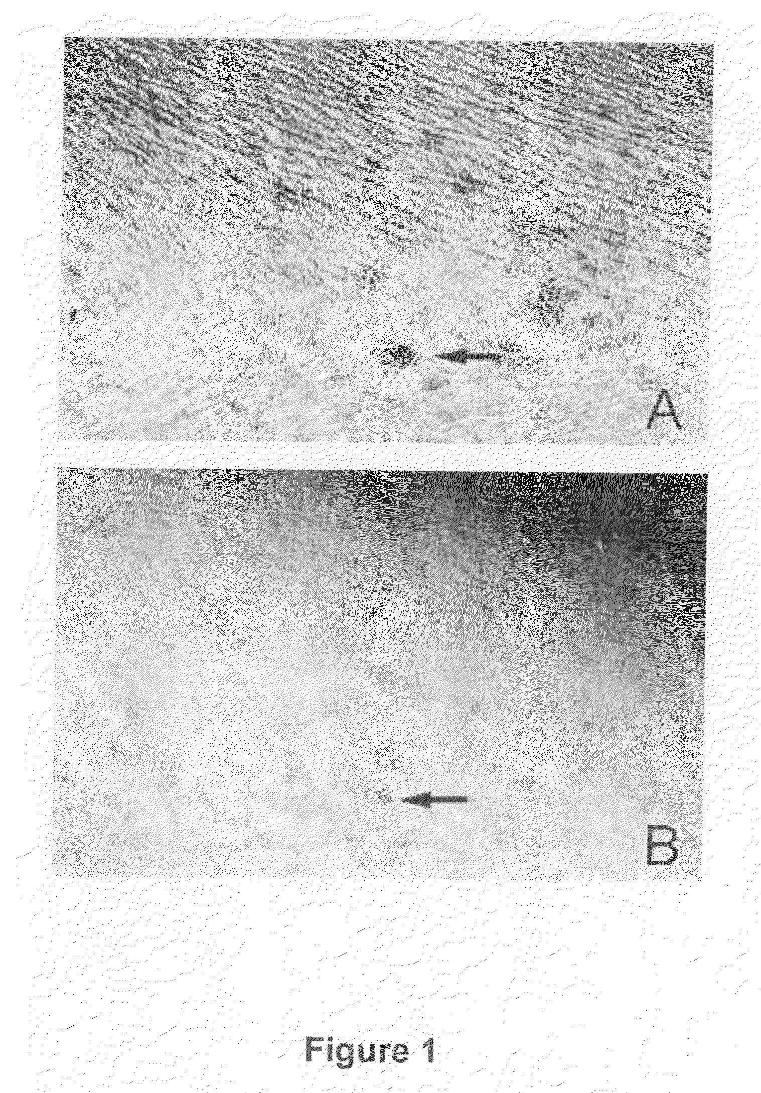 Use of 2,5-Dihydroxybenzene Derivatives for Treating Actinic Keratosis