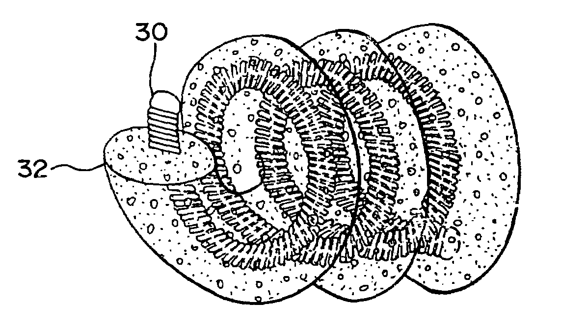 Foam matrix embolization device