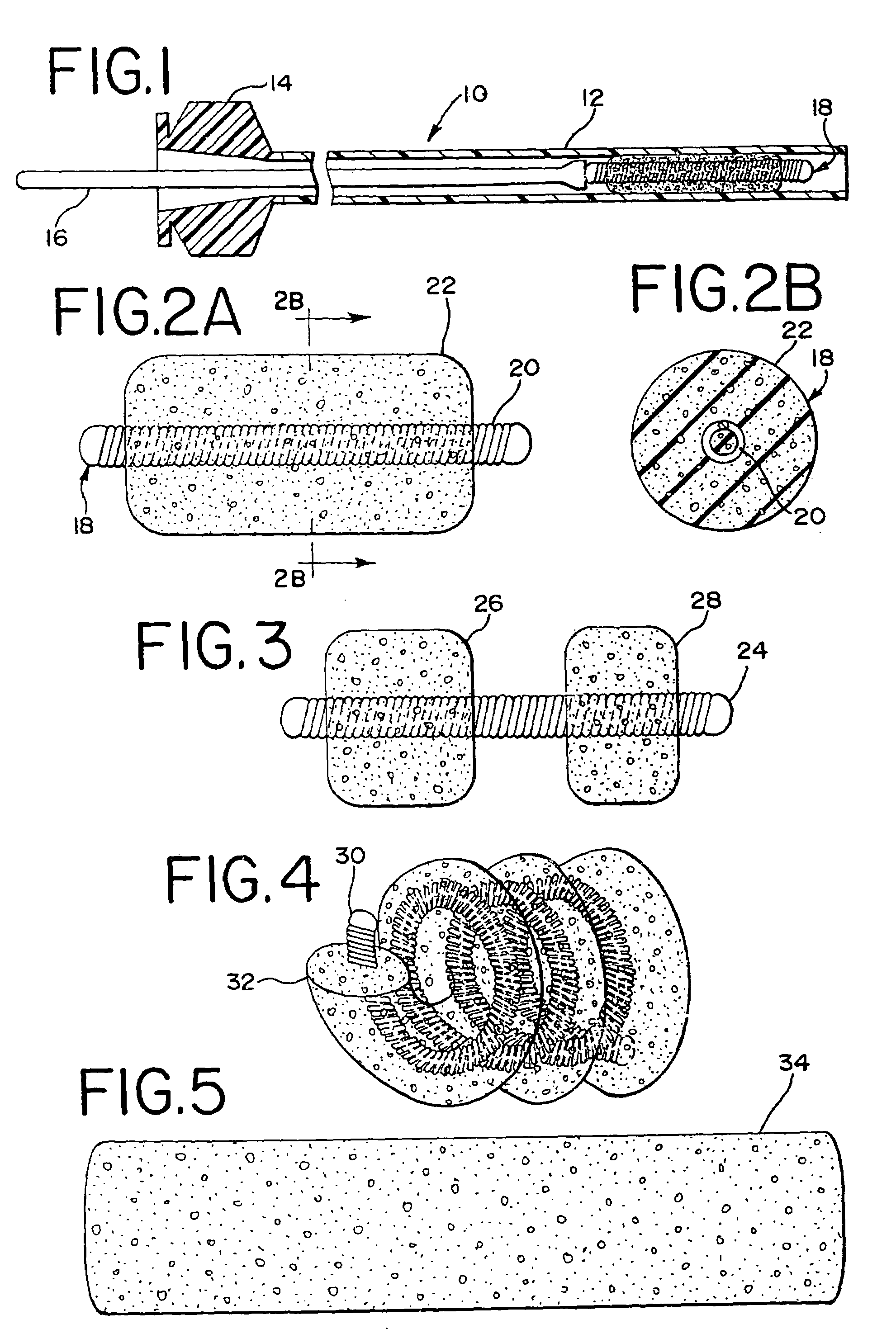 Foam matrix embolization device