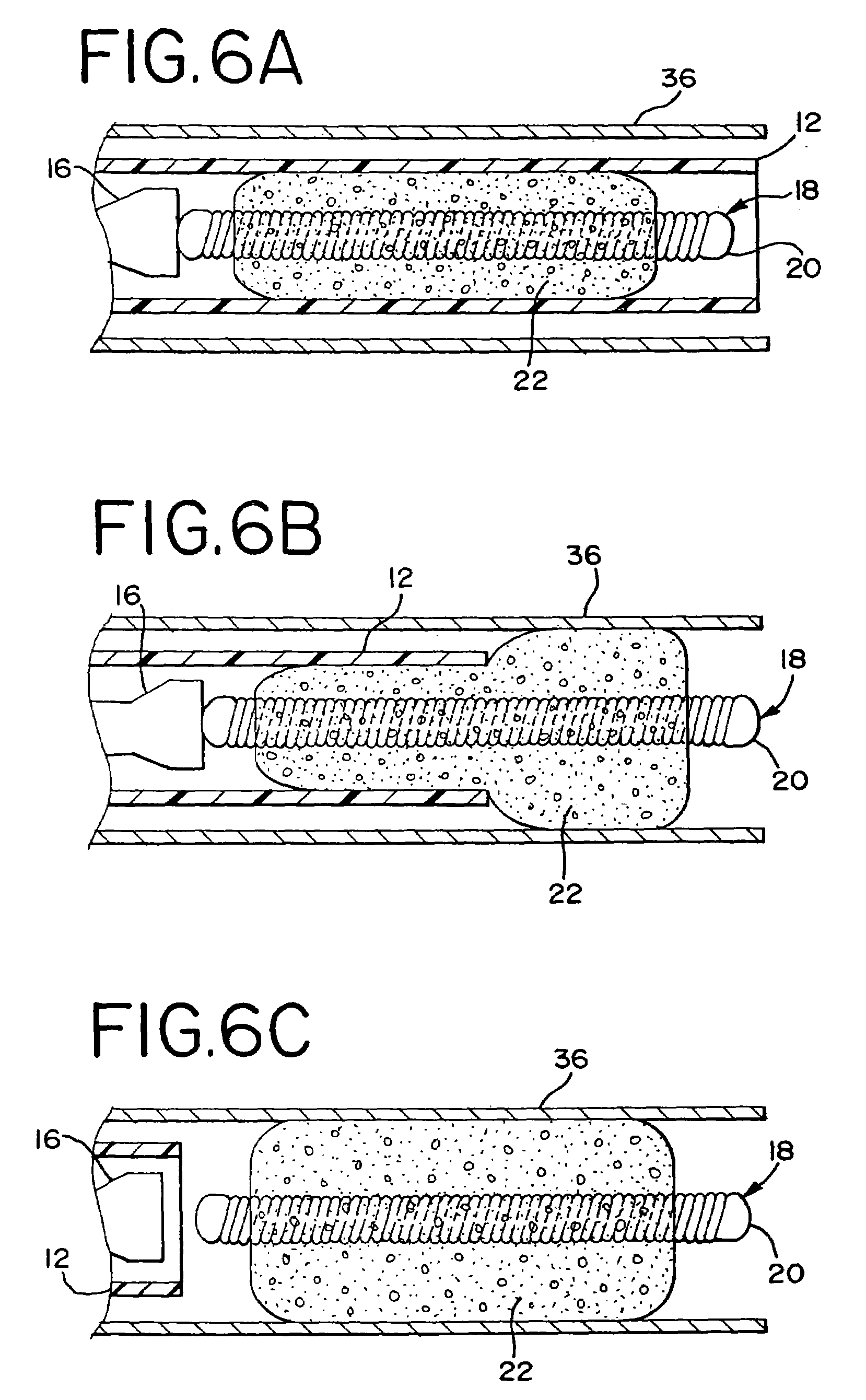 Foam matrix embolization device