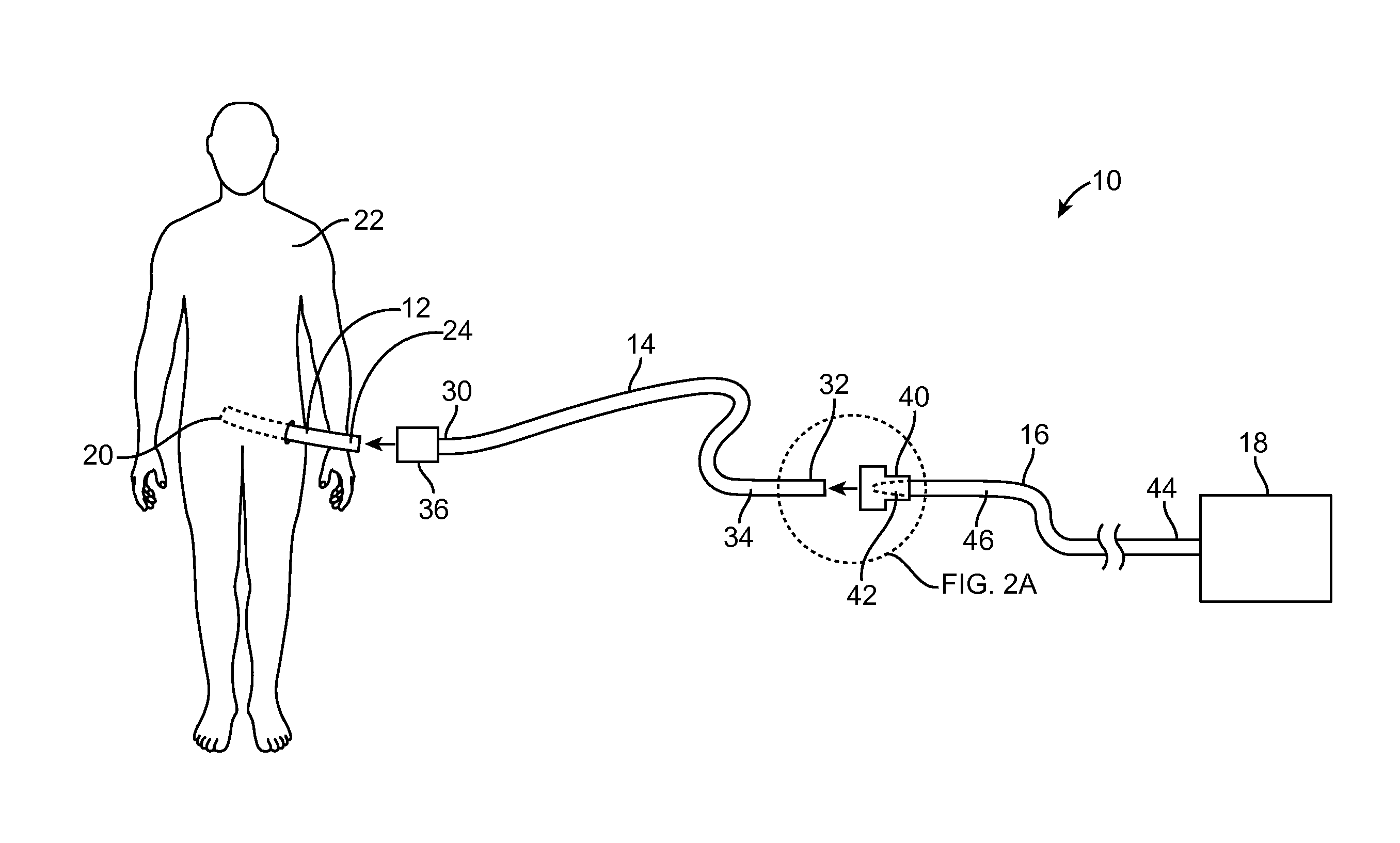 Systems and methods for increasing sterilization during peritoneal dialysis