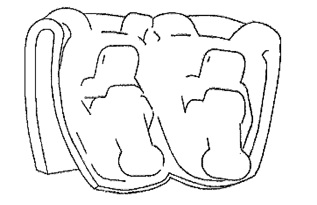 Method for Manufacturing Positioning Tray and Bracket with Positioning Hook for Manufacturing Positioning Tray