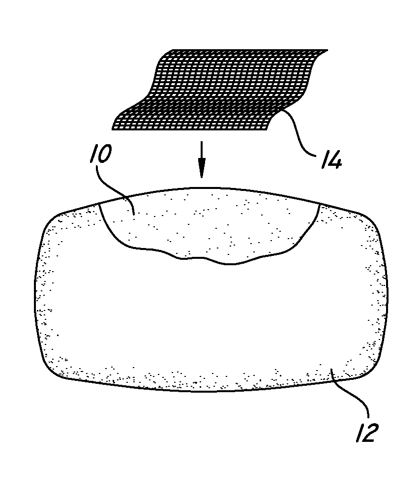 Reinforced surgical adhesives and sealants and their in-situ application