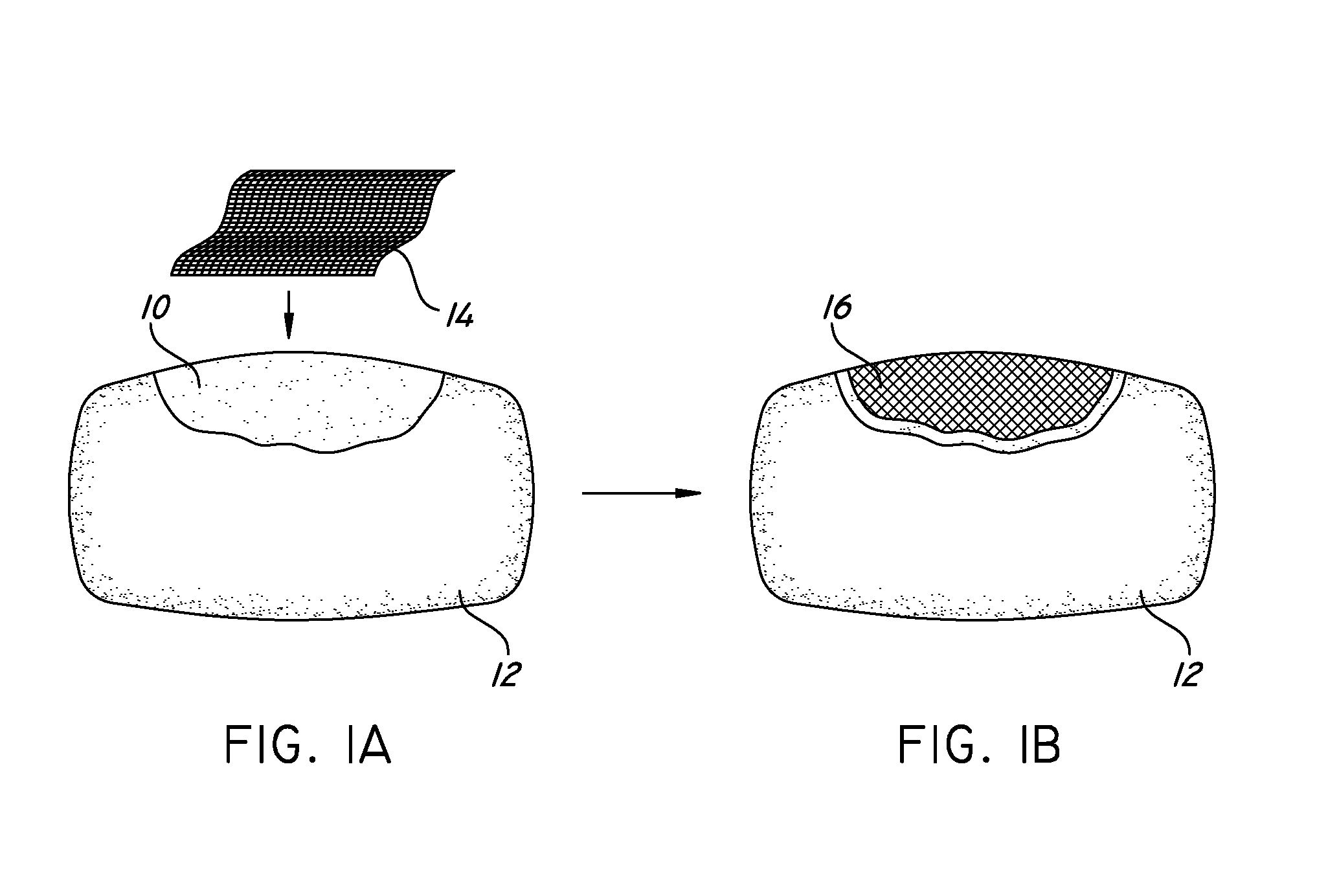 Reinforced surgical adhesives and sealants and their in-situ application