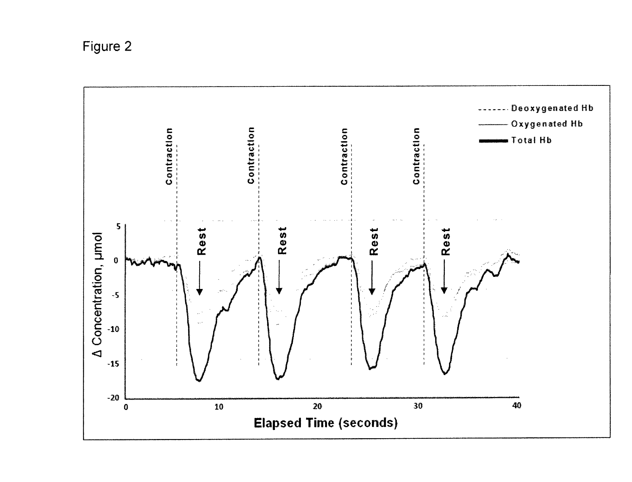 Monitoring urodynamics by trans-vaginal nirs